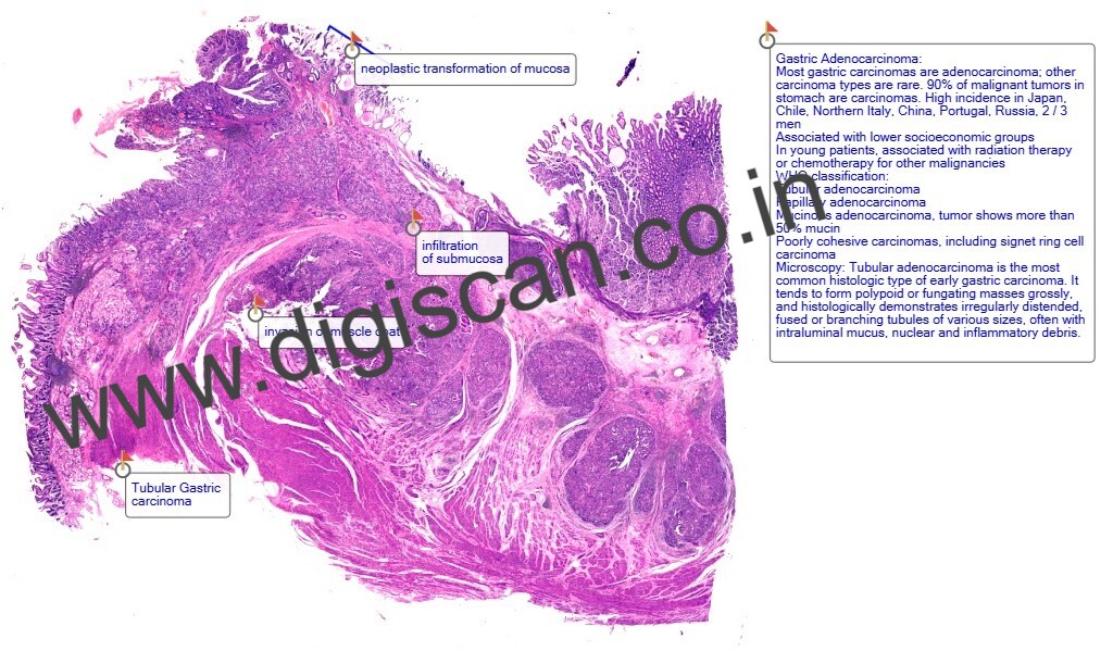 Digital Histopathology Slide Sets (With Annotated Histology Slides)
